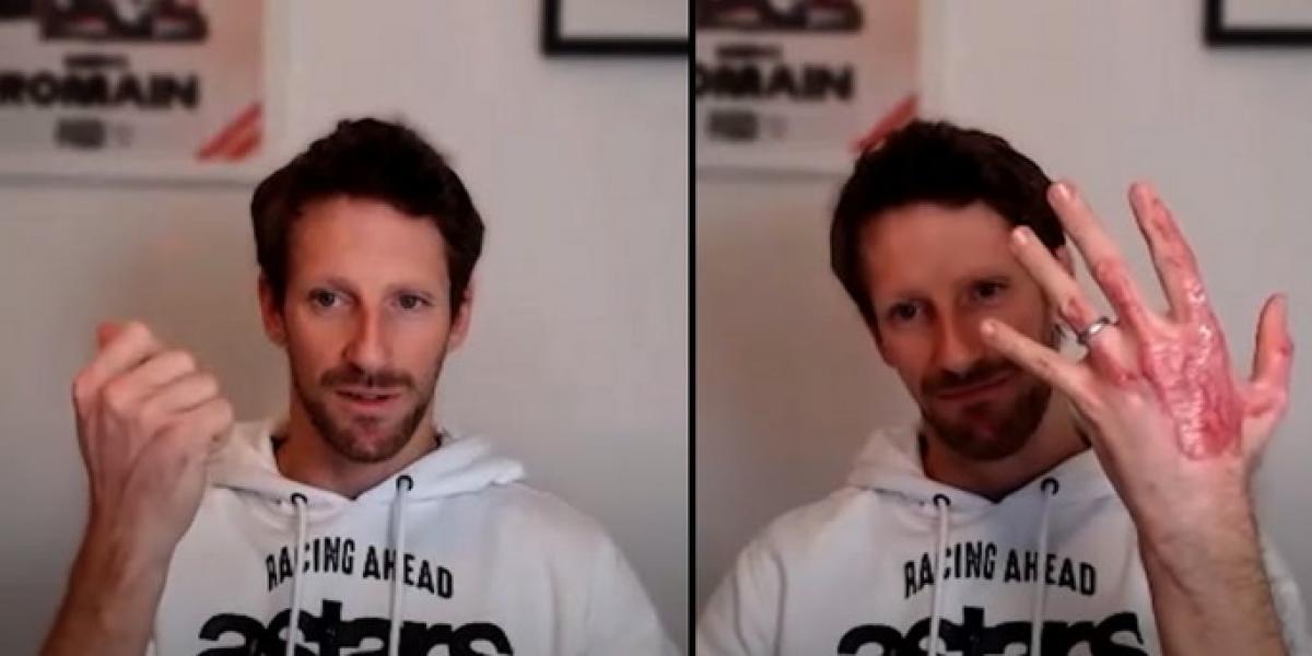 Así está la mano de Romain Grosjean un año después de su accidente en Bahréin