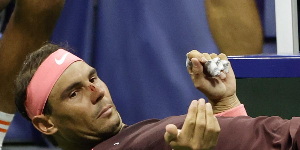 Rafa Nadal: Pensé que me había roto la nariz