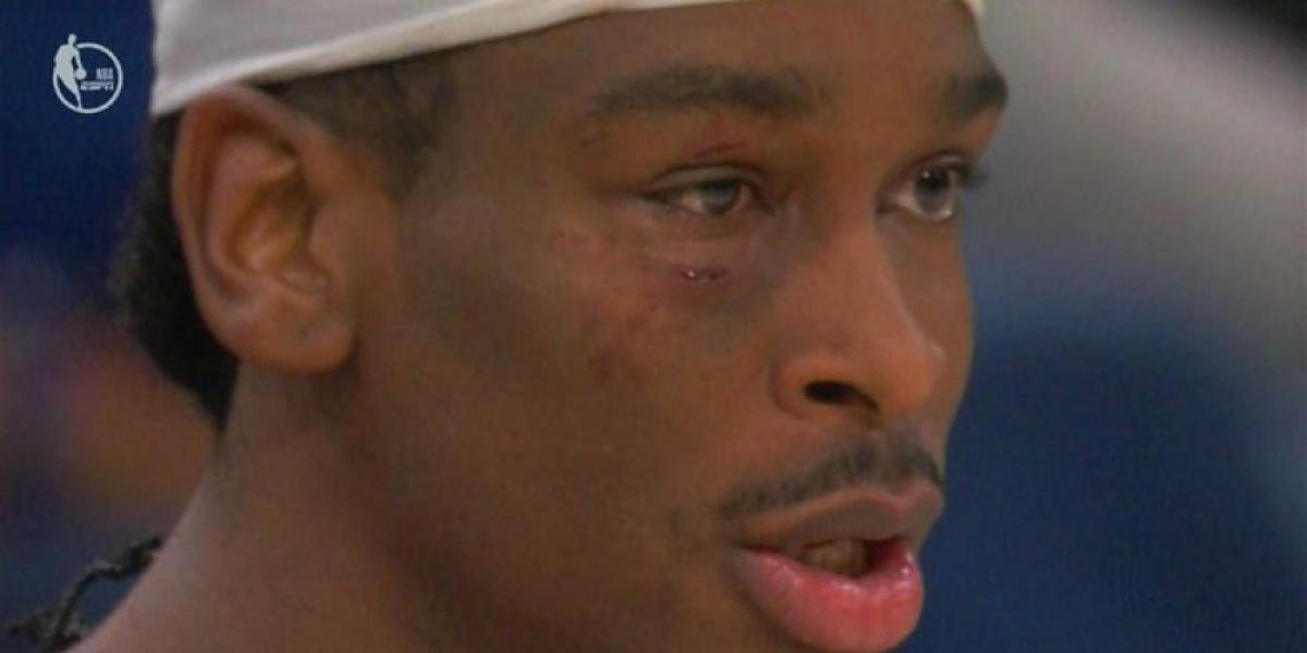 Gobert vuelve con los codos afilados: así quedó la cara de Gilgeous-Alexander