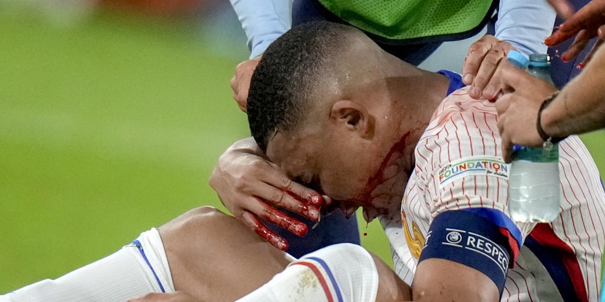 Mbappé se libra de ser operado