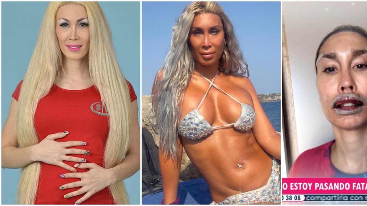 La Pelopony, irreconocible tras su última cirugía extrema de 9.000 euros: así ha cambiado después de participar en Supervivientes